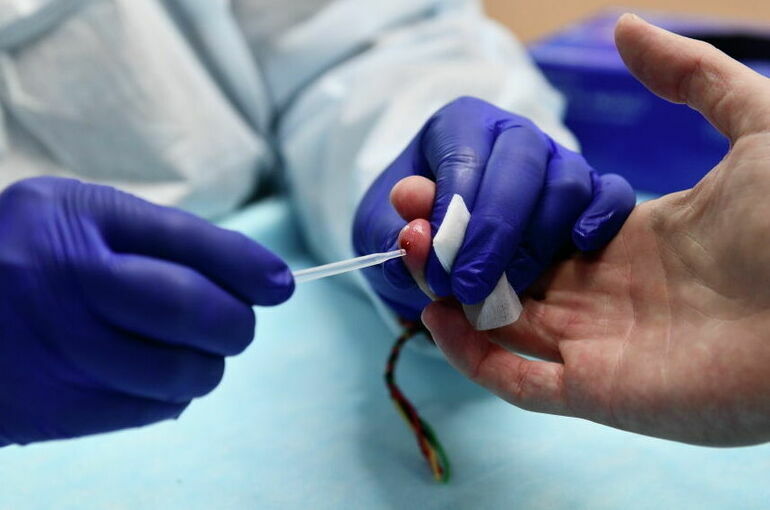 В Смоленской области доступен бесплатный тест на ВИЧ-инфекцию
